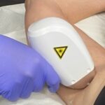 laser hair removal plano tx