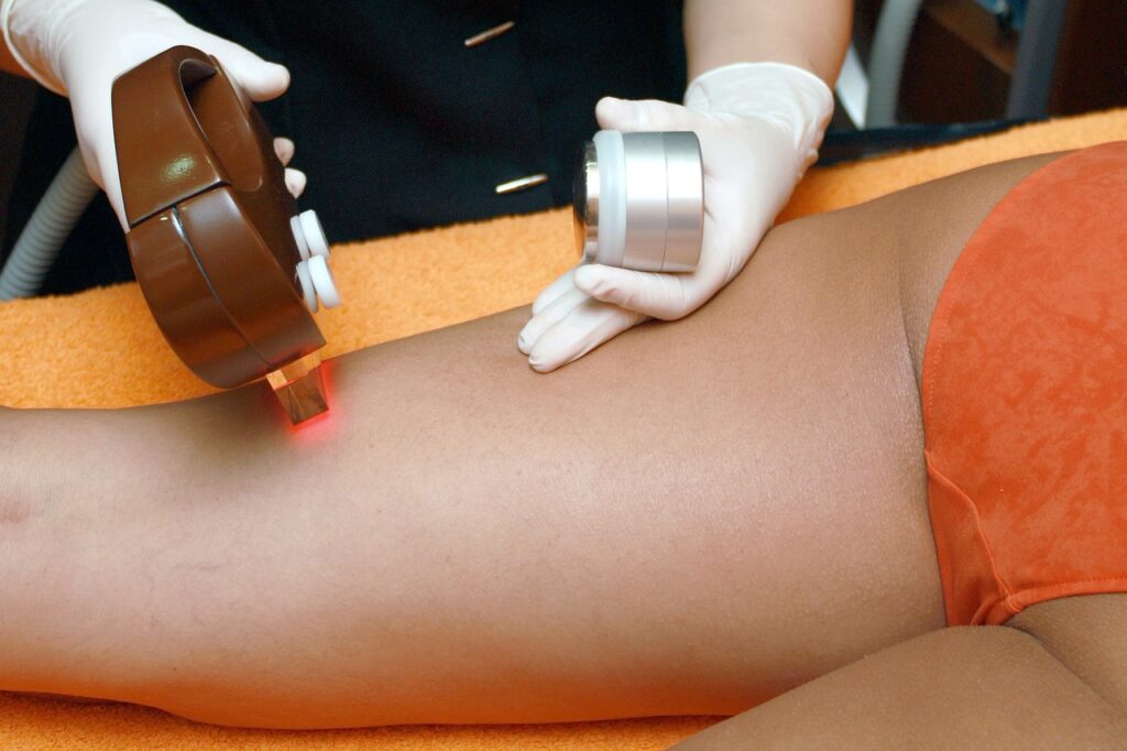 laser hair removal plano tx