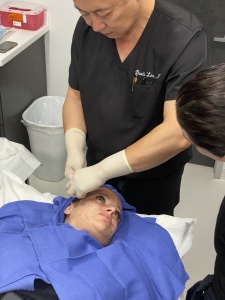thread lift face lift
