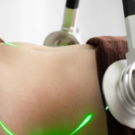 laser body contouring service plano tx dr doohi lee